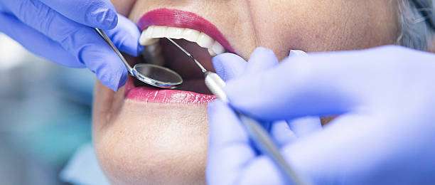 Best Emergency Dental Extractions in Beckett Ridge, OH
